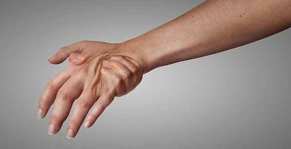 2689_Kalbitor-hand_954x492