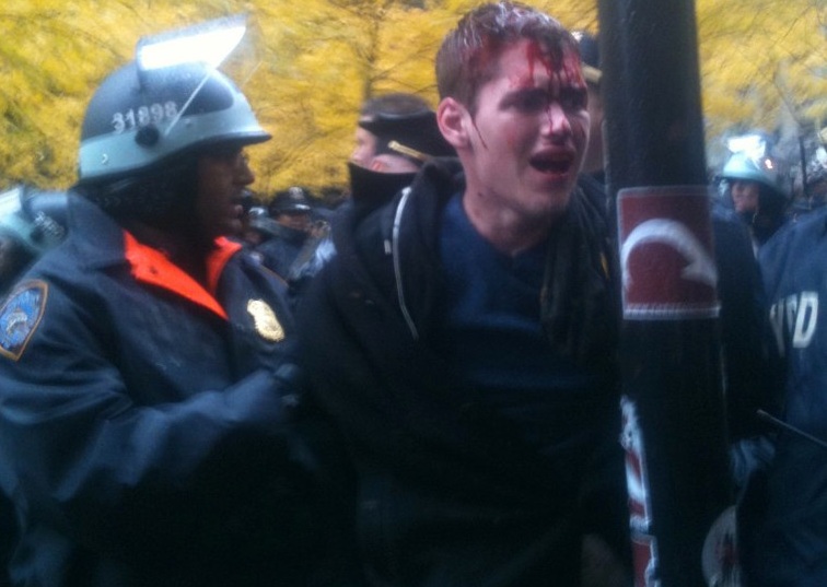 OWS_bloody