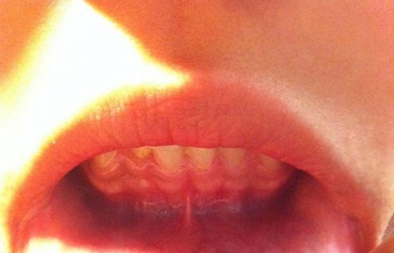 Remember Inner Lip Tattoos??