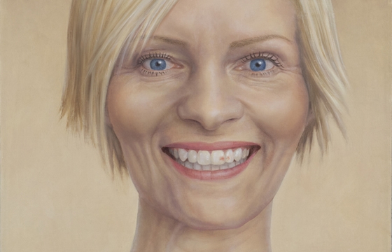 Facial Fallout Series by Reiner Hansen