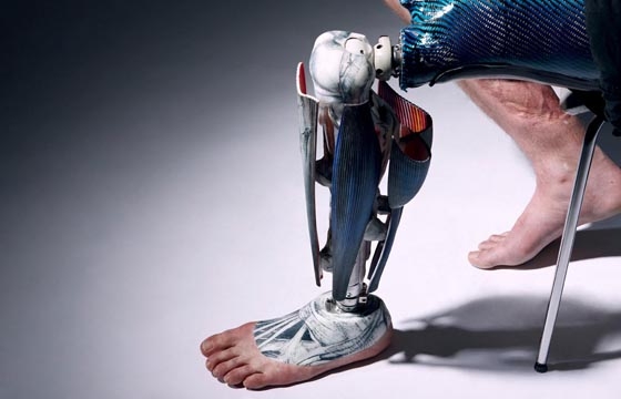 Fashionable Prosthetics from The Alternative Limb Project