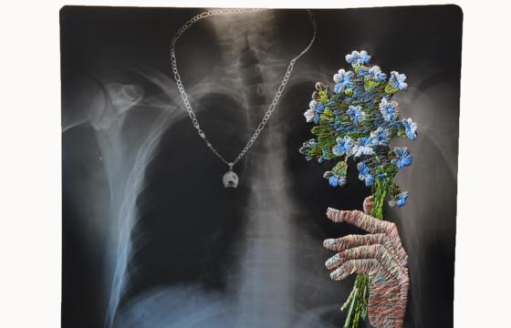 Embroidered X-Rays by Matthew Cox
