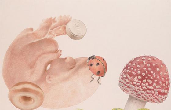 Alfred Steiner's Illustrative Surgery