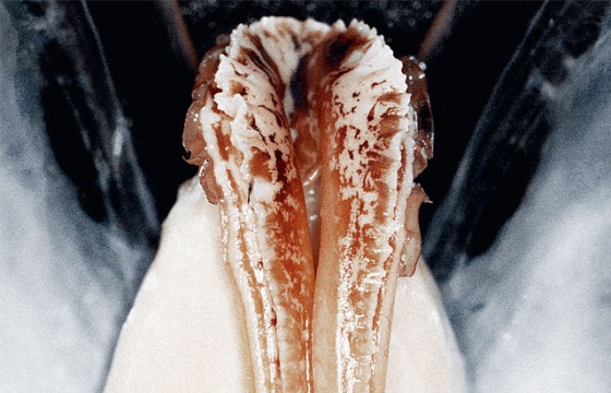 Peter Kaaden's Zu Nah