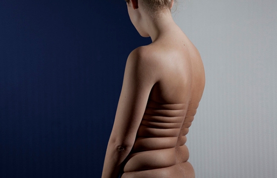 Stretching the Limits of Skin