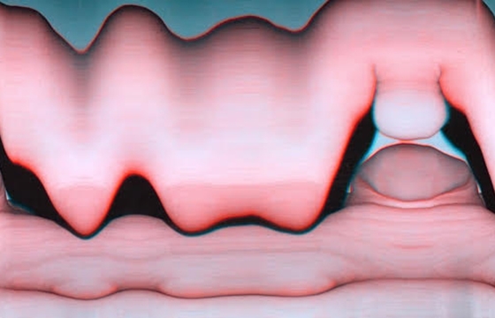 Holly Buckle's "Sticky Picnic"