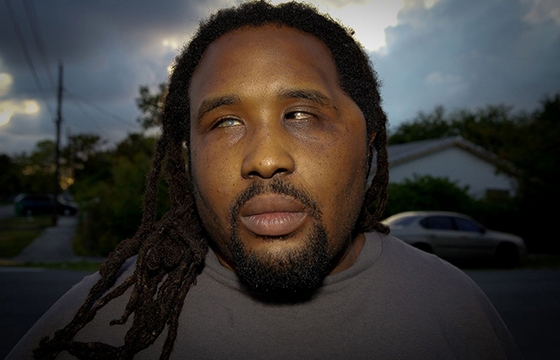 SHOT: 101 Survivors of Gun Violence in America